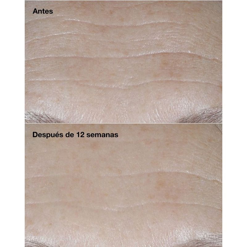CREMA-ANTIEDAD-CLINIQUE-SMART-CLINICAL-REPAIR-PROTECCION-TOTAL-SPF30