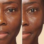 80095973_benefitresults_2_blind
